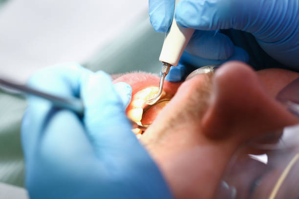 Best Walk-In Emergency Dental Services in Lake Bryan, TX