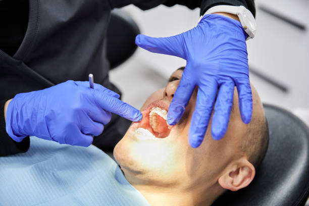 Best Emergency Care for Gum Disease in Lake Bryan, TX