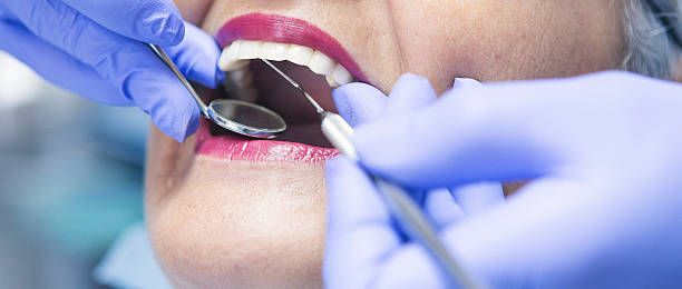 Best Broken or Chipped Tooth Repair in Lake Bryan, TX